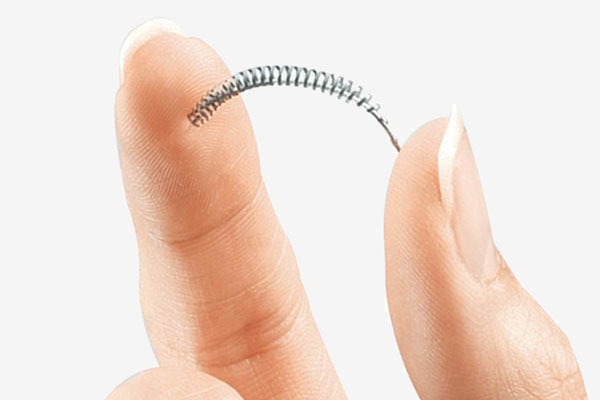 Essure Device; Essure birth control device being held 