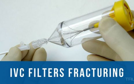 ivc filter fracture relatively common