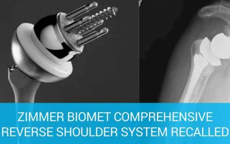 Zimmer Biomet Faulty Reverse Shoulder Implant Device; What Is A Reverse Shoulder Replacement Surgery; Zimmer Biomet Comprehensive Reverse Shoulder System; FDA RECALL – Zimmer Biomet Reverse Shoulder Injuries Lead To Recall Due To A High Fracture Rate; High Fracture Rate Of Zimmer Biomet Shoulder System Could Lead To Death; Zimmer Biomet Shoulder Replacement Timeline; Zimmer Biomet Reverse Shoulder Lawsuits