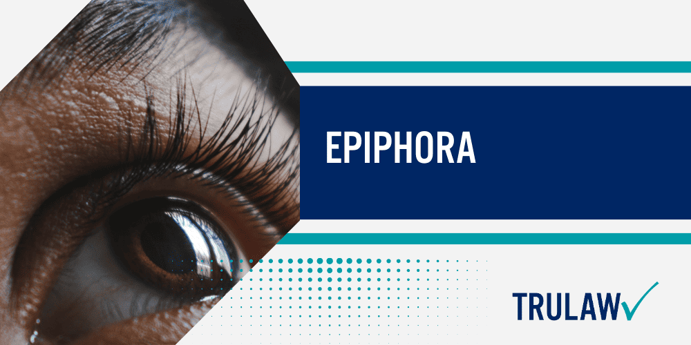 Taxotere Eye Injury Lawsuit; taxotere lawsuit, taxotere vision damage, taxotere eye injury lawsuit, taxotere vision loss lawsuit, taxotere vision loss, taxotere eye injuries, taxotere lacrimal duct obstruction, taxotere canalicular stenosis, taxotere litigation; How is Taxotere Administered; Who is Prescribed Medication like Taxotere; Taxotere Vision Damage Lawsuits; Taxotere Eye Injury; Nasolacrimal Duct Obstruction; Permanent Stenosis; Epiphora