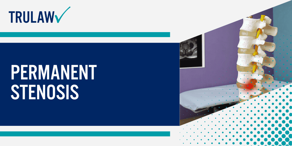 Taxotere Eye Injury Lawsuit; taxotere lawsuit, taxotere vision damage, taxotere eye injury lawsuit, taxotere vision loss lawsuit, taxotere vision loss, taxotere eye injuries, taxotere lacrimal duct obstruction, taxotere canalicular stenosis, taxotere litigation; How is Taxotere Administered; Who is Prescribed Medication like Taxotere; Taxotere Vision Damage Lawsuits; Taxotere Eye Injury; Nasolacrimal Duct Obstruction; Permanent Stenosis