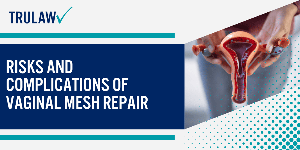 Understanding Vaginal Prolapse; Treatment Options for Vaginal Prolapse; Risks and Complications of Vaginal Mesh Repair