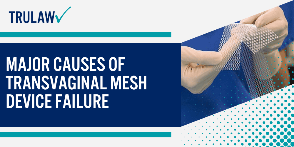 How Can A Transvaginal Mesh Attorney from TruLaw Help You; Major Causes of Transvaginal Mesh Device Failure