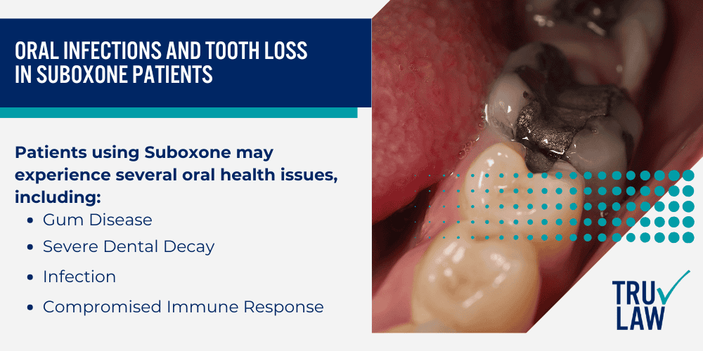 Weighing the Benefits and Risks of Suboxone Treatment; Oral Infections and Tooth Loss in Suboxone Patients