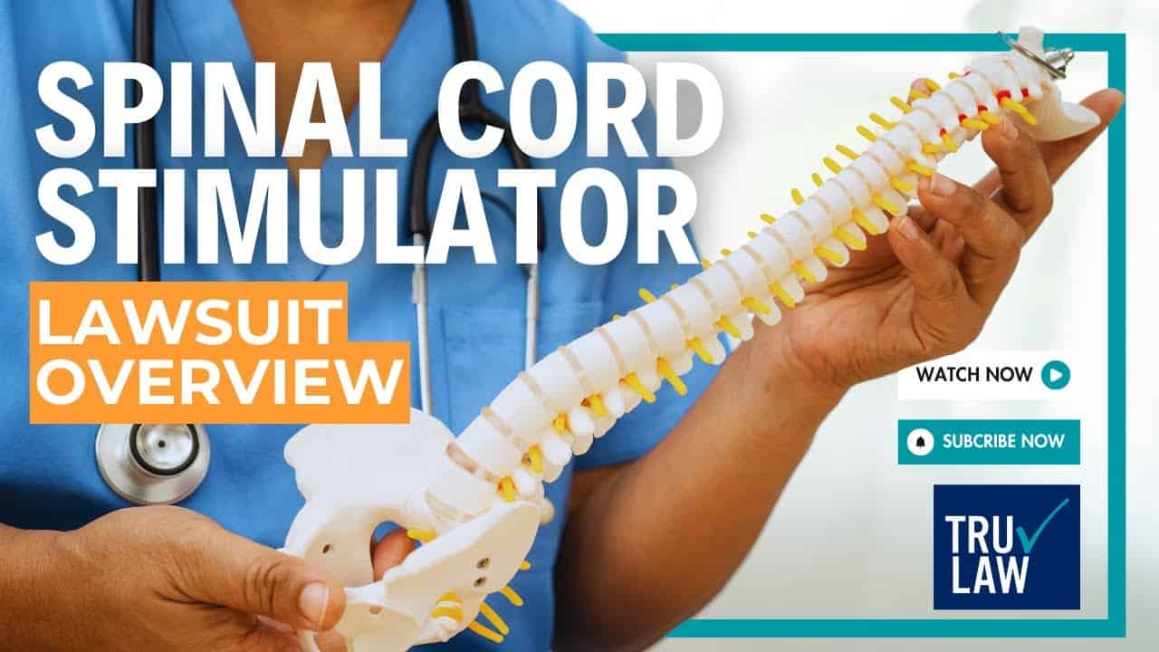 Spinal Cord Stimulator Lawsuit Overview
