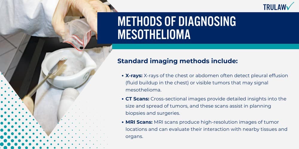 Methods of Diagnosing Mesothelioma