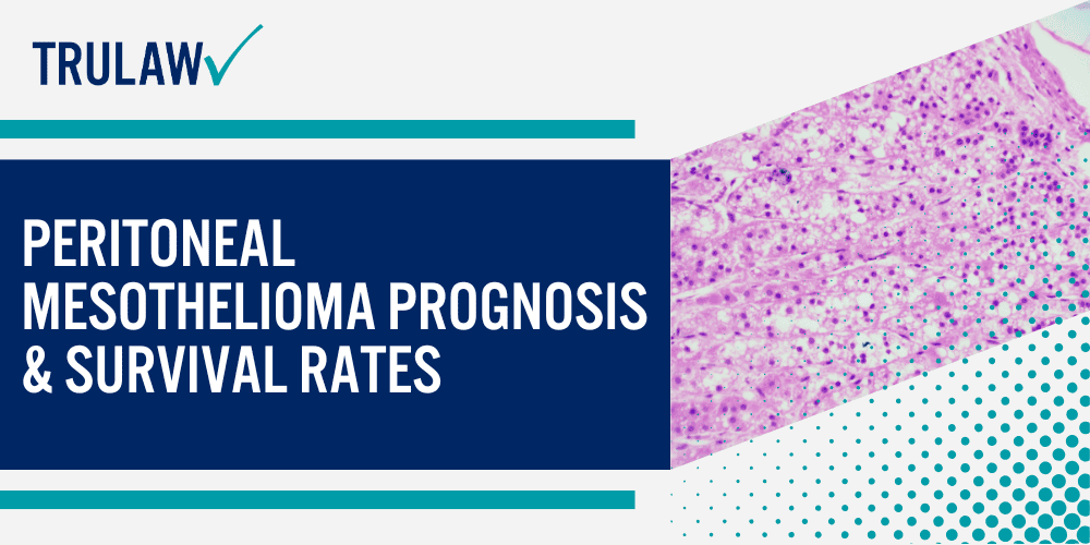 Clinical Presentation of Peritoneal Mesothelioma; Initial Peritoneal Mesothelioma Screening Procedures;  Living with Peritoneal Mesothelioma; Treatment Options for Peritoneal Mesothelioma; Peritoneal Mesothelioma Prognosis & Survival Rates