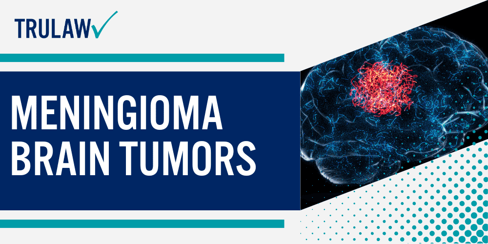 What are Meningiomas (Brain Tumors); Diagnosing the Symptoms of Meningiomas; Meningiomas Treatment Options; Meningioma Brain Tumors