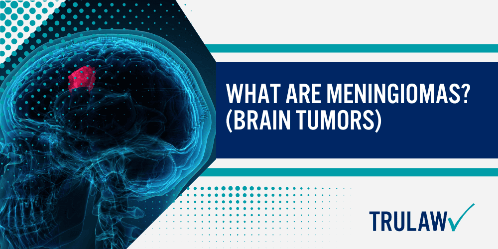 What are Meningiomas (Brain Tumors)