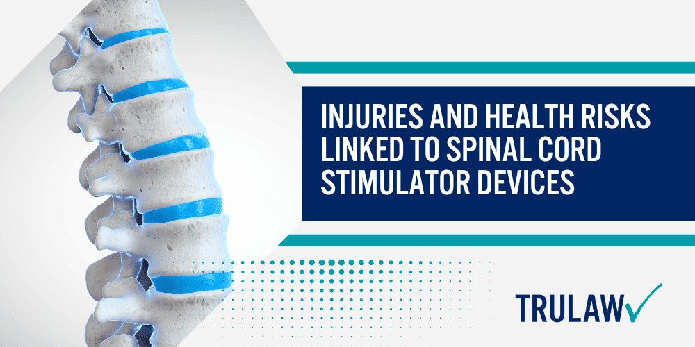 Spinal Cord Stimulator Lawsuit Overview; Injuries and Health Risks Linked to Spinal Cord Stimulator Devices
