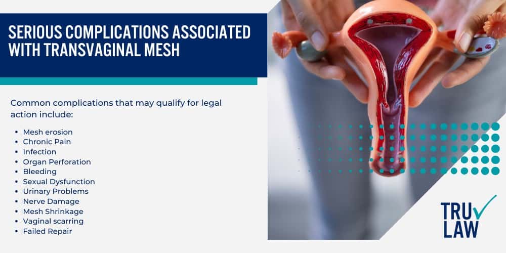 How Can A Transvaginal Mesh Attorney from TruLaw Help You; How much does it cost to hire a Transvaginal Mesh lawyer from TruLaw; Overview of the Transvaginal Mesh Litigation; Current Status of Transvaginal Mesh Litigation; Transvaginal Mesh Settlements and Verdicts; Transvaginal Mesh Settlement Values Explained; Serious Complications Associated with Transvaginal Mesh