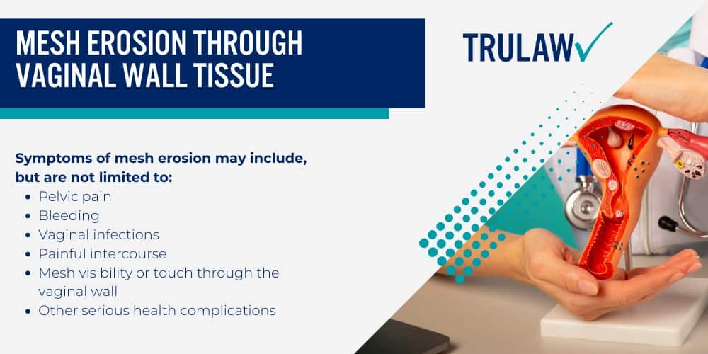 How Can A Transvaginal Mesh Attorney from TruLaw Help You; How much does it cost to hire a Transvaginal Mesh lawyer from TruLaw; Allegations Against Surgical Mesh Manufacturers; Transvaginal Mesh Causing Severe Internal Damage; Mesh Erosion Through Vaginal Wall Tissue