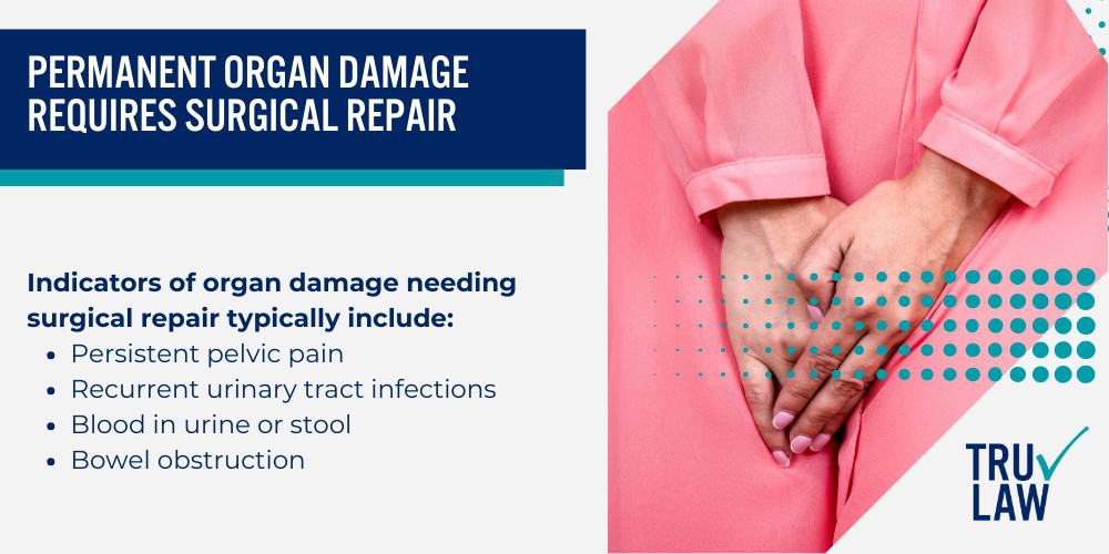 How Can A Transvaginal Mesh Attorney from TruLaw Help You; How much does it cost to hire a Transvaginal Mesh lawyer from TruLaw; Allegations Against Surgical Mesh Manufacturers; Transvaginal Mesh Causing Severe Internal Damage; Mesh Erosion Through Vaginal Wall Tissue; Permanent Organ Damage Requires Surgical Repair